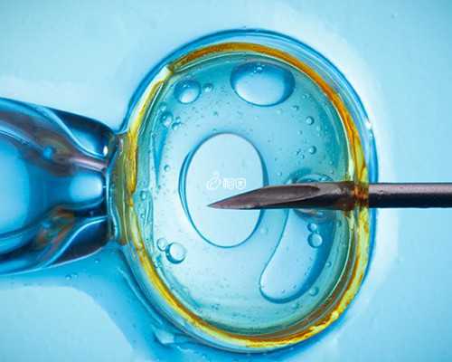 美国试管卵泡监测重要吗，具体如何操作？-助孕中介